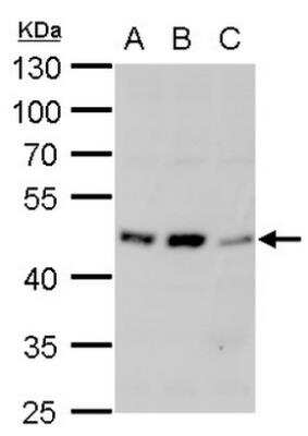 Western Blot: alpha-1A Adrenergic R/ADRA1A Antibody [NB100-78585] - A. Jurkat whole cell lysate/extract. B. Raji whole cell lysate/extract. C. NCI-H929 whole cell lysate/extract. 10 % SDS-PAGE alpha 1a Adrenergic Receptor antibody dilution: 1:1000