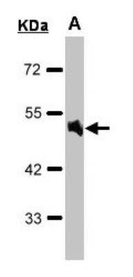 Western Blot alpha-1A Adrenergic R/ADRA1A Antibody