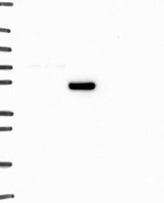 Western Blot: alpha-1A Adrenergic R/ADRA1A Antibody [NBP3-17211] - Lane 1: Marker [kDa] 250, 130, 95, 72, 55, 36, 28, 17, 10;   Lane 2: RT4;   Lane 3: U-251 MG;   Lane 4: Human Plasma;   Lane 5: Liver;   Lane 6: Tonsil