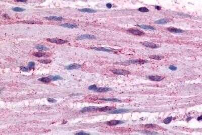 Immunohistochemistry-Paraffin: alpha-1B Adrenergic R/ADRA1B Antibody - BSA Free [NBP1-02325] - Staining of human smooth muscle cells. Immunohistochemistry of formalin-fixed, paraffin-embedded tissue after heat-induced antigen retrieval. Antibody concentration 10 ug/ml.