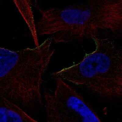 Immunocytochemistry/Immunofluorescence: alpha-1B Adrenergic R/ADRA1B Antibody [NBP2-57288] - Staining of human cell line U-251 MG shows localization to plasma membrane.