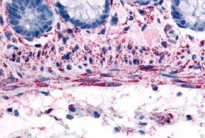Immunohistochemistry-Paraffin: alpha-1B Adrenergic R/ADRA1B Antibody [NBP1-02348] - Staining of human smooth muscle cells. Immunohistochemistry of formalin-fixed, paraffin-embedded tissue after heat-induced antigen retrieval. Antibody concentration 10 ug/ml.