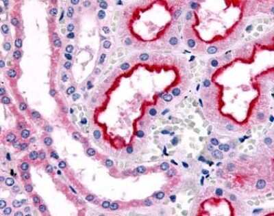 Immunohistochemistry-Paraffin: alpha-1B Adrenergic R/ADRA1B Antibody [NLS698] - Medullary Collecting Duct