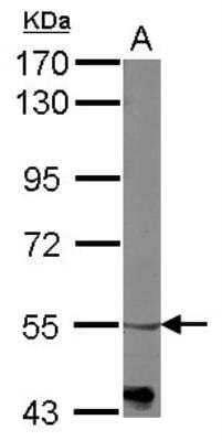 Western Blot: alpha-1B Adrenergic R/ADRA1B Antibody [NBP2-15351] - Sample (50 ug of whole cell lysate) A: Mouse brain 7. 5% SDS PAGE; antibody diluted at 1:1000.