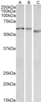 Western Blot alpha-1B Adrenergic R/ADRA1B Antibody