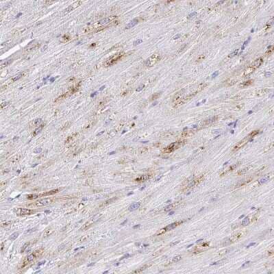 Immunohistochemistry-Paraffin: alpha 1B-Glycoprotein Antibody [NBP2-33419] - Staining of human Heart muscle shows moderate cytoplasmic positivity in cardiomyocytes.