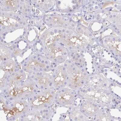 Immunohistochemistry-Paraffin: alpha 1B-Glycoprotein Antibody [NBP2-33419] - Staining of human Kidney shows moderate extracellular space positivity in cells in tubules.