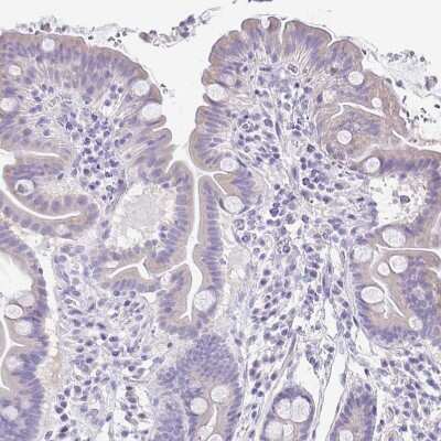 Immunohistochemistry-Paraffin: alpha 1B-Glycoprotein Antibody [NBP2-33419] - Staining of human Small intestine shows weak cytoplasmic positivity in glandular cells.