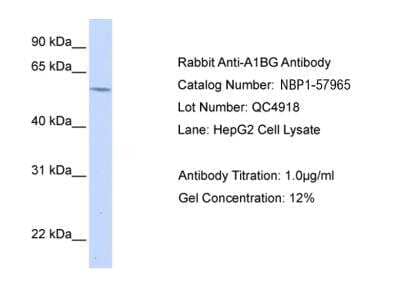 Western Blot: alpha 1B-Glycoprotein Antibody [NBP1-57965] - Reccomended Titration: 1.25 ug/mlPositive Control: HepG2 Whole Cell ACAT2 is supported by BioGPS gene expression data to be expressed in HepG2