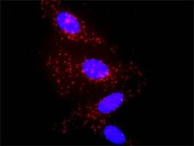 Proximity Ligation Assay: alpha 2-Macroglobulin Antibody (2B5) [H00000002-M03] - Analysis of protein-protein interactions between IL1B and A2M. HeLa cells were stained with anti-IL1B rabbit purified polyclonal 1:1200 and anti-A2M mouse monoclonal antibody 1:50. Each red dot represents the detection of protein-protein interaction complex, and nuclei were counterstained with DAPI (blue).