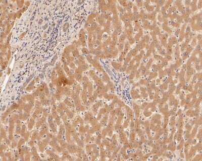 Immunohistochemistry-Paraffin: alpha 2-Macroglobulin Antibody (3-G5) [NBP2-67141] - Immunohistochemical analysis of paraffin-embedded human liver tissue using anti-alpha 2-Macroglobulin antibody. The section was pre-treated using heat mediated antigen retrieval with Tris-EDTA buffer (pH 8.0-8.4) for 20 minutes. The tissues were blocked in 5% BSA for 30 minutes at room temperature, washed with ddH2O and PBS, and then probed with the primary antibody (1/100) for 30 minutes at room temperature. The detection was performed using an HRP conjugated compact polymer system. DAB was used as the chromogen. Tissues were counterstained with hematoxylin and mounted with DPX.