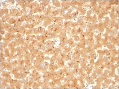 Immunohistochemistry-Paraffin: alpha 2-Macroglobulin Antibody (A2M/3623) [NBP3-08689] - Formalin-fixed, paraffin-embedded human liver stained with alpha 2-Macroglobulin Mouse Monoclonal Antibody (A2M/3623).
