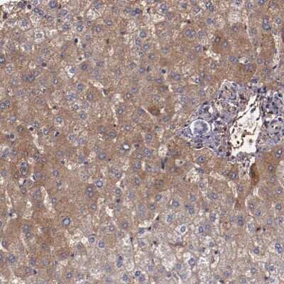 Immunohistochemistry-Paraffin: alpha 2-Macroglobulin Antibody [NBP1-85491] - Staining of human liver shows moderate cytoplasmic positivity in hepatocytes.