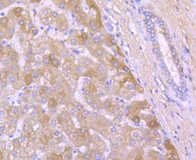 Immunohistochemistry-Paraffin: alpha 2-Macroglobulin Antibody (JM81-41) [NBP2-67137] - Analysis of paraffin-embedded human liver tissue using anti- A2M antibody. Counter stained with hematoxylin.