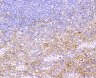 Immunohistochemistry-Paraffin: alpha 2-Macroglobulin Antibody (JM81-41) [NBP2-67137] - Analysis of paraffin-embedded human spleen tissue using anti- A2M antibody. Counter stained with hematoxylin.
