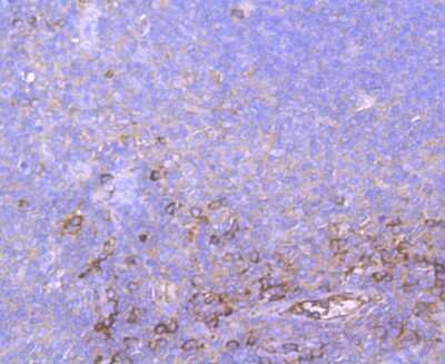 Immunohistochemistry-Paraffin: alpha 2-Macroglobulin Antibody (JM81-41) [NBP2-67137] - Analysis of paraffin-embedded human tonsil tissue using anti- A2M antibody. Counter stained with hematoxylin.