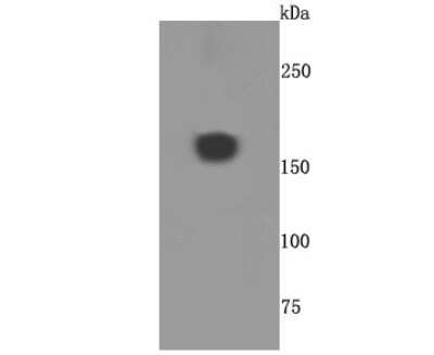 Western Blot: alpha 2-Macroglobulin Antibody (JM81-41) [NBP2-67137] - Analysis of A2M on human placenta tissue lysates using anti-A2M antibody at 1/500 dilution.