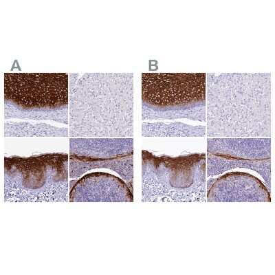 Immunohistochemistry-Paraffin: alpha 2-Macroglobulin-like 1/A2ML1 Antibody [NBP1-84392] - Staining of human esophagus, liver, skin and tonsil using Anti-A2ML1 antibody NBP1-84392 (A) shows similar protein distribution across tissues to independent antibody NBP2-32647 (B).
