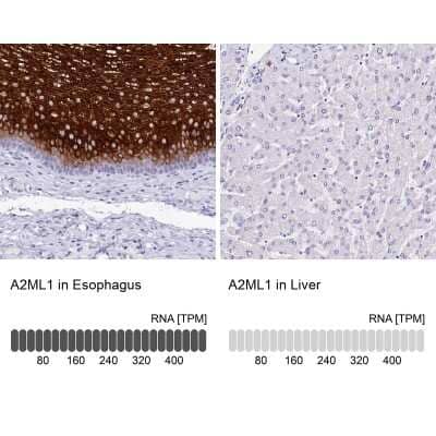 Immunohistochemistry-Paraffin: alpha 2-Macroglobulin-like 1/A2ML1 Antibody [NBP1-84392] - Analysis in human esophagus and liver tissues. Corresponding A2ML1 RNA-seq data are presented for the same tissues.