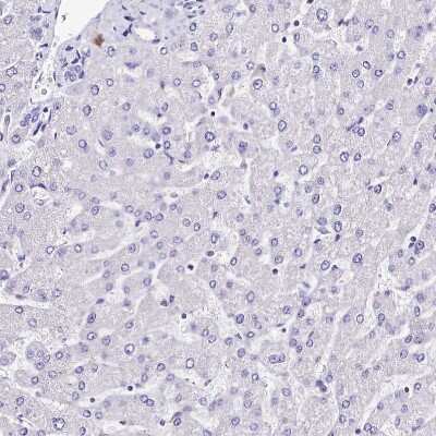 Immunohistochemistry-Paraffin: alpha 2-Macroglobulin-like 1/A2ML1 Antibody [NBP1-84392] - Staining of human liver shows no positivity in hepatocytes as expected.