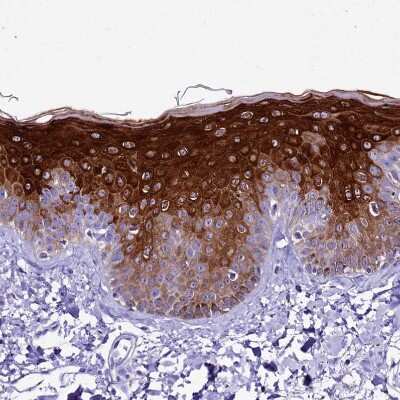 Immunohistochemistry-Paraffin: alpha 2-Macroglobulin-like 1/A2ML1 Antibody [NBP1-84392] - Staining of human skin shows strong cytoplasmic positivity in epidermal cells.