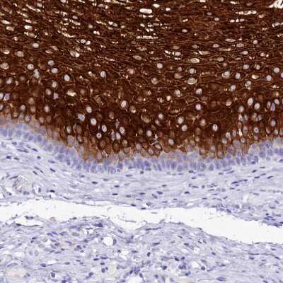 Immunohistochemistry-Paraffin: alpha 2-Macroglobulin-like 1/A2ML1 Antibody [NBP1-84392] - Staining of human esophagus shows strong cytoplasmic positivity in squamous epithelial cells.