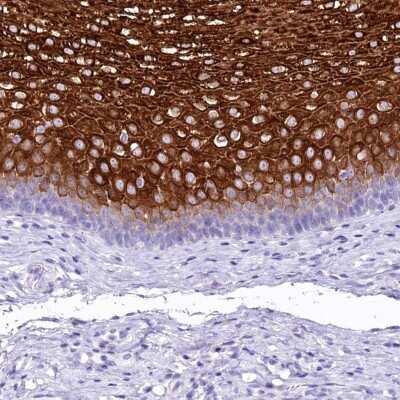 Immunohistochemistry-Paraffin: alpha 2-Macroglobulin-like 1/A2ML1 Antibody [NBP2-32647] - Staining of human esophagus shows high expression.