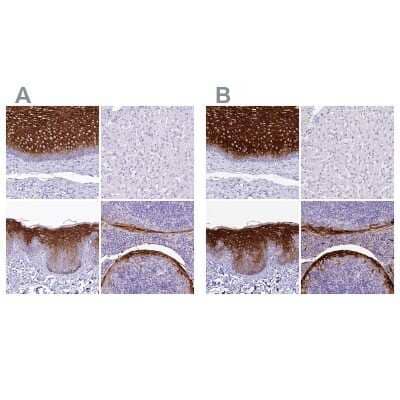 <b>Independent Antibodies Validation and Orthogonal Strategies Validation.</b>Immunohistochemistry-Paraffin: alpha 2-Macroglobulin-like 1/A2ML1 Antibody [NBP2-32647] - Staining of human esophagus, liver, skin and tonsil using Anti-A2ML1 antibody NBP2-32647 (A) shows similar protein distribution across tissues to independent antibody NBP1-84392 (B).