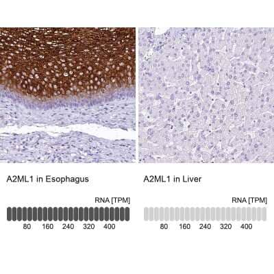 Immunohistochemistry-Paraffin alpha 2-Macroglobulin-like 1/A2ML1 Antibody - BSA Free