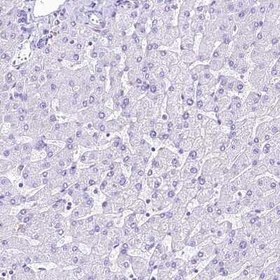 Immunohistochemistry-Paraffin: alpha 2-Macroglobulin-like 1/A2ML1 Antibody [NBP2-32647] - Staining of human liver shows no positivity in hepatocytes as expected.
