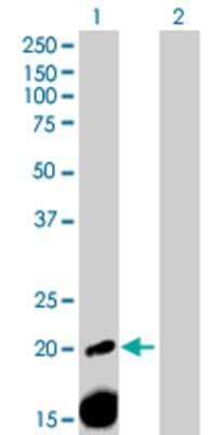 Western Blot: alpha 2-Macroglobulin-like 1/A2ML1 Antibody [H00144568-B01P] - Analysis of A2ML1 expression in transfected 293T cell line by A2ML1 MaxPab polyclonal antibody. Lane1: A2ML1 transfected lysate (17.38 KDa). Lane2: Non-transfected lysate.