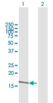 Western Blot: alpha 2-Macroglobulin-like 1/A2ML1 Antibody [H00144568-B01P] - Analysis of A2ML1 expression in transfected 293T cell line by A2ML1 polyclonal antibody.  Lane1:A2ML1 transfected lysate(17.38 KDa). Lane2:Non-transfected lysate.