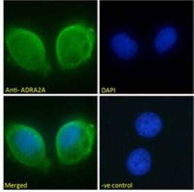 Immunocytochemistry/ Immunofluorescence alpha-2A Adrenergic R/ADRA2A Antibody