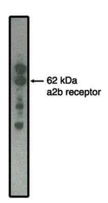 Western Blot: alpha-2B Adrenergic R/ADRA2B Antibody (5G10) [NBP2-66606] - alpha2B adrenergic receptor antibody on MDCK cells transfected to produce alpha2B receptor protein.