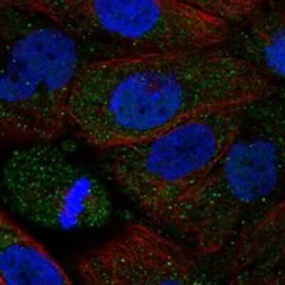 Immunocytochemistry/Immunofluorescence: alpha-2B Adrenergic R/ADRA2B Antibody [NBP3-17799] - Staining of human cell line EFO-21 shows localization to vesicles.