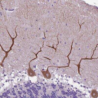 Immunohistochemistry-Paraffin: alpha-2B Adrenergic R/ADRA2B Antibody [NBP2-49470] - Staining of human cerebellum shows strong cytoplasmic positivity in Purkinje cells.