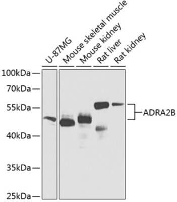 Western Blot: alpha-2B Adrenergic R/ADRA2B Antibody [NBP2-92556] - Analysis of extracts of various cell lines, using alpha-2B Adrenergic R/ADRA2B at 1:1000 dilution.Secondary antibody: HRP Goat Anti-Rabbit IgG (H+L) at 1:10000 dilution.Lysates/proteins: 25ug per lane.Blocking buffer: 3% nonfat dry milk in TBST.Detection: ECL Basic Kit .Exposure time: 10s.
