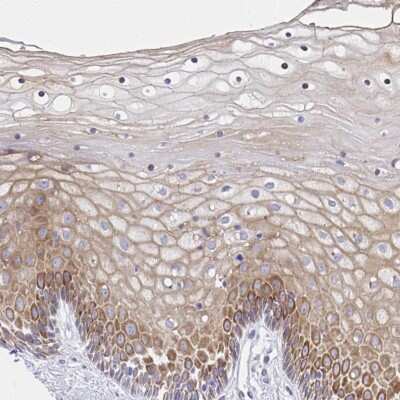 Immunohistochemistry-Paraffin: alpha-2C Adrenergic R/ADRA2C Antibody [NBP2-33845] - Staining of human cervix, uterine shows moderate cytoplasmic positivity in squamous epithelial cells.