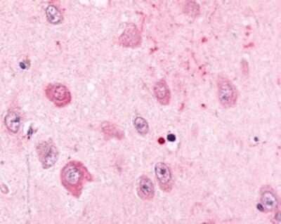 Immunohistochemistry-Paraffin: alpha-2C Adrenergic R/ADRA2C Antibody [NLS3990] - Staining of Human Brain, Neurons of Area CA1