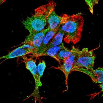 Immunocytochemistry/Immunofluorescence: alpha-2C Adrenergic R/ADRA2C Antibody (S330A-80) [NBP2-22397] - Tissue: Neuroblastoma cell line SK-N-BE. Species: Human. Fixation: 4% Formaldehyde for 15 min at RT. Primary Antibody: Mouse Anti-Alpha-2C Adrenergic Receptor Monoclonal Antibody at 1:100 for 60 min at RT. Secondary Antibody: Goat Anti-Mouse ATTO 488 at 1:100 for 60 min at RT. Counterstain: Phalloidin Texas Red F-Actin stain; DAPI (blue) nuclear stain at 1:1000, 1:5000 for 60min RT, 5min RT. Localization: Cell Membrane, Nucleus. Magnification: 60X.