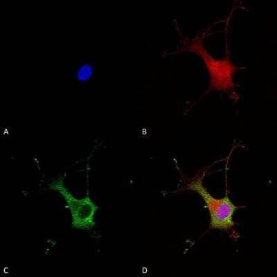 Immunocytochemistry/Immunofluorescence: alpha-2C Adrenergic R/ADRA2C Antibody (S330A-80) [NBP2-22397] - Immunocytochemistry/Immunofluorescence analysis using Mouse Anti-Alpha-2C Adrenergic Receptor Monoclonal Antibody, Clone S330A-80 (NBP2-22397). Tissue: Neuroblastoma cells (SH-SY5Y). Species: Human. Fixation: 4% PFA for 15 min. Primary Antibody: Mouse Anti-Alpha-2C Adrenergic Receptor Monoclonal Antibody (NBP2-22397) at 1:100 for overnight at 4C with slow rocking. Secondary Antibody: AlexaFluor 488 at 1:1000 for 1 hour at RT. Counterstain: Phalloidin-iFluor 647 (red) F-Actin stain; Hoechst (blue) nuclear stain at 1:800, 1.6mM for 20 min at RT. (A) Hoechst (blue) nuclear stain. (B) Phalloidin-iFluor 647 (red) F-Actin stain. (C) Alpha-2C Adrenergic Receptor Antibody (D) Composite.