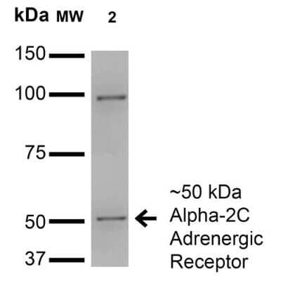 Western Blot: alpha-2C Adrenergic R/ADRA2C Antibody (S330A-80) [NBP2-22397] - Western Blot analysis of Monkey COS cells transfected with HA-tagged Alpha-2C showing detection of ~50 kDa Alpha-2C Adrenergic Receptor protein using Mouse Anti-Alpha-2C Adrenergic Receptor Monoclonal Antibody, Clone S330A-80 (NBP2-22397). Lane 1: Molecular Weight Ladder. Lane 2: Monkey COS cells transfected with HA-tagged Alpha-2C. Load: 15 ug. Block: 2% BSA and 2% Skim Milk in 1X TBST. Primary Antibody: Mouse Anti-Alpha-2C Adrenergic Receptor Monoclonal Antibody (NBP2-22397) at 1:200 for 16 hours at 4C. Secondary Antibody: Goat Anti-Mouse IgG: HRP at 1:1000 for 1 hour RT. Color Development: ECL solution for 6 min in RT. Predicted/Observed Size: ~50 kDa.