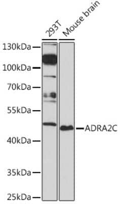 Western Blot: alpha-2C Adrenergic R/ADRA2C Antibody [NBP3-15504] - Western blot analysis of extracts of various cell lines, using alpha-2C Adrenergic R/ADRA2C Rabbit pAb (NBP3-15504) at 1:1000 dilution. Secondary antibody: HRP Goat Anti-Rabbit IgG (H+L) at 1:10000 dilution. Lysates/proteins: 25ug per lane. Blocking buffer: 3% nonfat dry milk in TBST. Detection: ECL Basic Kit. Exposure time: 90s.