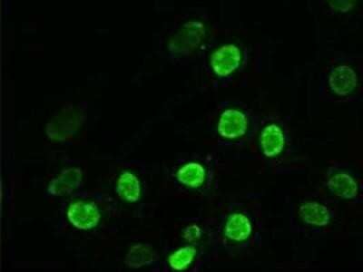 Immunocytochemistry/Immunofluorescence: alpha-Actinin 1 Antibody (OTI7A4) - Azide and BSA Free [NBP2-70078] - Staining of Hela cells transiently transfected by pCMV6-ENTRY Alpha Actinin 1.