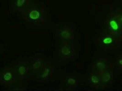 Immunocytochemistry/Immunofluorescence: alpha-Actinin 1 Antibody (OTI7A4) - Azide and BSA Free [NBP2-70078] - Staining of HeLa cells using anti-Alpha Actinin 1 mouse monoclonal antibody.