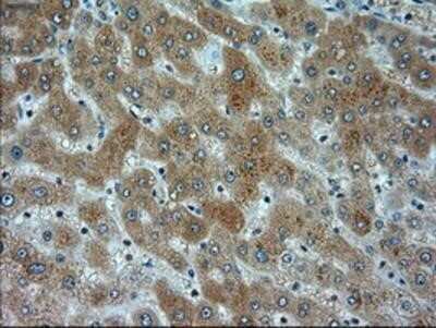 Immunohistochemistry: alpha-Actinin 1 Antibody (OTI7A4) - Azide and BSA Free [NBP2-70078] - Staining of paraffin-embedded Human liver tissue using anti-Alpha Actinin 1 mouse monoclonal antibody.