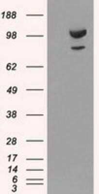 Western Blot: alpha-Actinin 1 Antibody (OTI7A4) - Azide and BSA Free [NBP2-70078] - HEK293T cells were transfected with the pCMV6-ENTRY control (Left lane) or pCMV6-ENTRY Alpha Actinin 1 (Right lane) cDNA for 48 hrs and lysed. Equivalent amounts of cell lysates (5 ug per lane) were separated by SDS-PAGE and immunoblotted with anti-Alpha