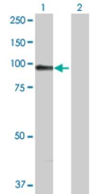 Western Blot: alpha-Actinin 1 Antibody [H00000087-D01P] - Analysis of ACTN1 expression in transfected 293T cell line by ACTN1 polyclonal antibody.Lane 1: ACTN1 transfected lysate(103.10 KDa).Lane 2: Non-transfected lysate.