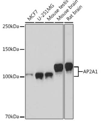Western Blot: alpha Adaptin Antibody (8R8B6) [NBP3-16402] - Western blot analysis of extracts of various cell lines, using alpha Adaptin Rabbit mAb (NBP3-16402) at 1:1000 dilution. Secondary antibody: HRP Goat Anti-Rabbit IgG (H+L) at 1:10000 dilution. Lysates/proteins: 25ug per lane. Blocking buffer: 3% nonfat dry milk in TBST. Detection: ECL Basic Kit. Exposure time: 90s.