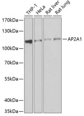 Western Blot: alpha Adaptin Antibody [NBP2-92798] - Analysis of extracts of various cell lines, using alpha Adaptin at 1:1000 dilution.Secondary antibody: HRP Goat Anti-Rabbit IgG (H+L) at 1:10000 dilution.Lysates/proteins: 25ug per lane.Blocking buffer: 3% nonfat dry milk in TBST.Detection: ECL Basic Kit .Exposure time: 10s.